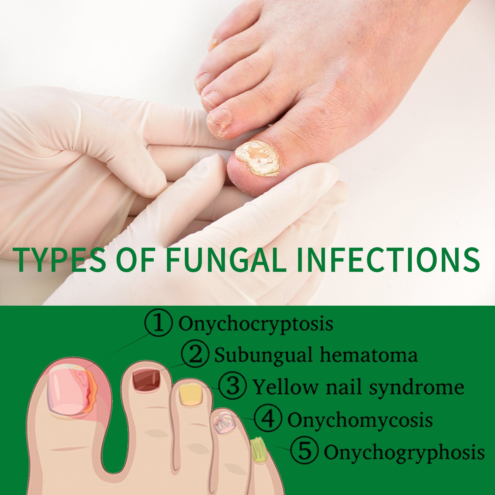 Ginger Nail Care Liqui