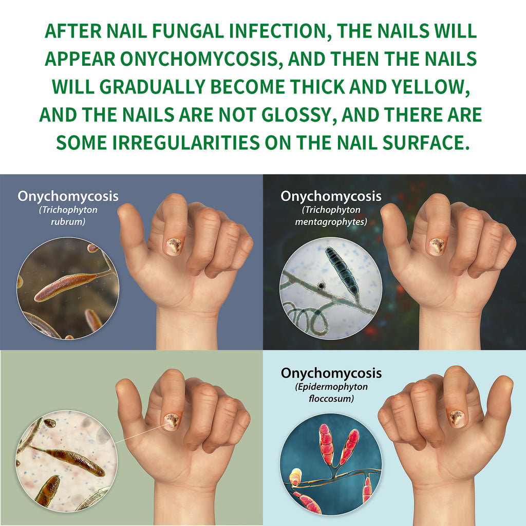 Ginger Nail Care Liqui